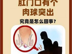 肛门口摸到个软软的肉是怎么回事？该如何消除？