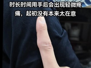 晚上打扑克时手疼、胳膊疼，如何解决？