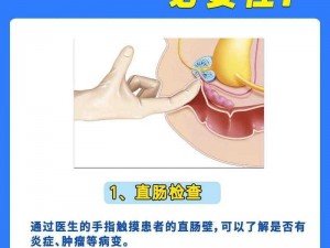 教授为何又来指检 gB 文章？原来是这样或教授怎样又来指检 gB 文章？原因竟是......