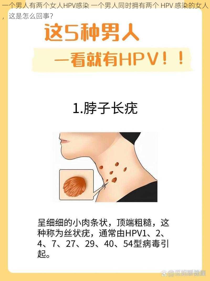 一个男人有两个女人HPV感染 一个男人同时拥有两个 HPV 感染的女人，这是怎么回事？